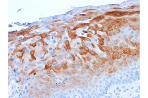 Formalin-fixed, paraffin-embedded human Cervix stained with Cytokeratin 1 Mouse Monoclonal Antibody (LHK1).