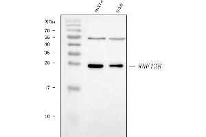 Western blot analysis of HSD-4/RNF138 using anti-HSD-4/RNF138 antibody (ABIN7600632).