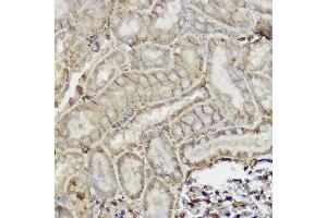 Immunohistochemistry of paraffin-embedded mouse kidney using P Glycoprotein Rabbit pAb (ABIN6134229, ABIN6136340, ABIN6136343 and ABIN6215453) at dilution of 1:250 (40x lens). (ABCB1 anticorps  (AA 600-700))