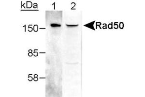 Image no. 2 for anti-RAD50 Homolog (S. Cerevisiae) (RAD50) antibody (ABIN363487) (RAD50 anticorps)