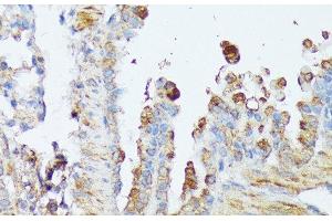 Immunohistochemistry of paraffin-embedded Mouse lung using WNT1 Polyclonal Antibody at dilution of 1:100 (40x lens). (WNT1 anticorps)