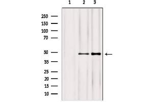 Western blot analysis of extracts from various samples, using NOB1 antibody. (NOB1 anticorps  (C-Term))