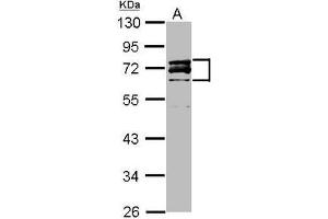 Western Blot: Lamin A/C antibody staining of HeLa Nucleus (A) (20 µg) at 1/3000 dilution, 10% SDS PAGE. (Lamin A/C anticorps  (AA 59-249))