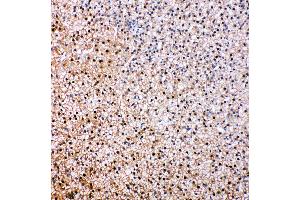 Anti-VCP antibody, IHC(P) IHC(P): Rat Epinephros Tissue