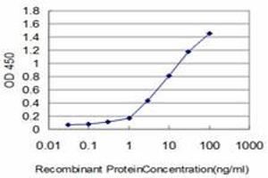Detection limit for recombinant GST tagged KIAA2002 is approximately 0.