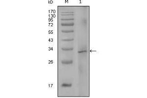 Western Blot showing F8 antibody used against truncated Trx-F8 recombinant protein (1). (Factor VIII anticorps)