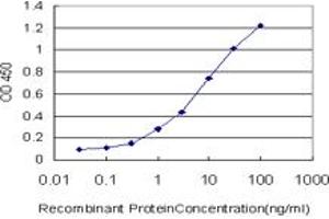 Detection limit for recombinant GST tagged RORB is approximately 0. (RORB anticorps  (AA 136-224))