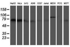 Image no. 2 for anti-5-Aminoimidazole-4-Carboxamide Ribonucleotide Formyltransferase/IMP Cyclohydrolase (ATIC) antibody (ABIN1496504) (ATIC anticorps)