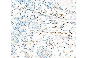 IHC analysis of CD68 using anti-CD68 antibody (ABIN7600142). (CD68 anticorps  (AA 154-354))