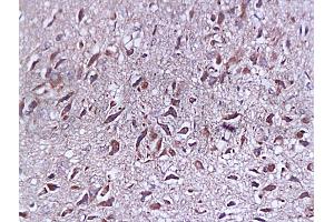 Formalin-fixed and paraffin embedded rat brain tissue labeled with Anti-SYP p38/Synaptophysin/SAP-1 Polyclonal Antibody, Unconjugated (ABIN725285) at 1:200, followed by conjugation to the secondary antibody and DAB staining (SYAP1 anticorps  (AA 151-230))