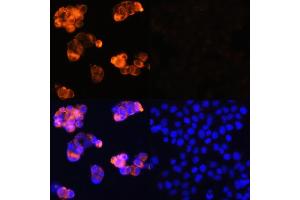 Immunofluorescence analysis of HepG2 cells (upper left) and LO2 cells (negative sample control) (upper right) using Alpha-Fetoprotein (Alpha-Fetoprotein (AFP)) Rabbit pAb (red, ABIN6129175, ABIN6136616, ABIN6136618 and ABIN6215038) at dilution of 1:100.