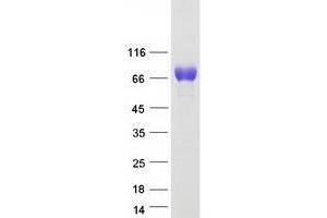 Validation with Western Blot