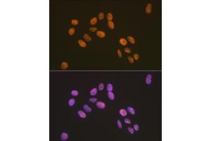 Immunofluorescence analysis of U-2 OS cells using ZBTB7A/FBI-1/LRF Rabbit mAb (ABIN7271439) at dilution of 1:100 (40x lens). (ZBTB7A anticorps)