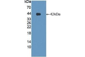 Detection of Recombinant LPHN3, Human using Polyclonal Antibody to Latrophilin 3 (LPHN3) (LPHN3 anticorps  (AA 1105-1447))
