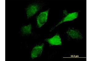 anti-Vav 1 Oncogene (VAV1) (AA 681-790) antibody