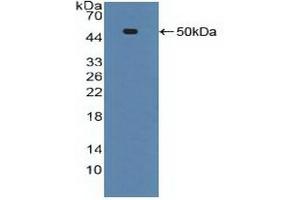 Detection of Recombinant ADRbK1, Human using Polyclonal Antibody to Tumor Necrosis Factor Receptor 1 (TNFR1) (TNFRSF1A anticorps  (AA 60-236))