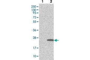 Western blot analysis of Lane 1: Negative control (vector only transfected HEK293T lysate). (TMEM159 anticorps)