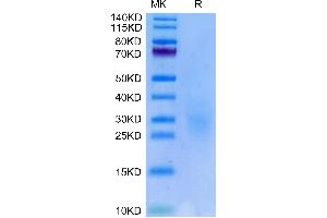 NKG2C & CD94 (AA 98-231) protein (His-Avi Tag,Biotin)