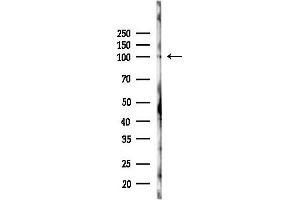 Western blot analysis of lysates from Rat brain, using NO Antibody at 1/1000 dilution.