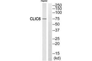 Western blot analysis of extracts from HepG2 cells, using CLIC6 antibody. (CLIC6 anticorps)