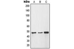 Western blot analysis of MMP12 expression in A549 (A), HEK293 (B), HeLa (C) whole cell lysates.