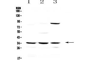 Western blot analysis of Alpha 1 microglobulin using anti-Alpha 1 microglobulin antibody . (AMBP anticorps  (AA 206-352))