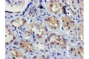Immunohistochemical staining of paraffin-embedded Human Kidney tissue using anti-FBXO21 mouse monoclonal antibody. (FBXO21 anticorps)