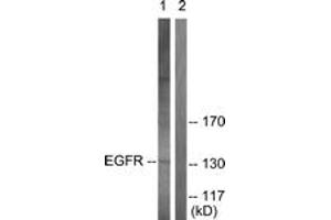 Western blot analysis of extracts from A431 cells, using EGFR (Ab-693) Antibody. (EGFR anticorps  (AA 661-710))
