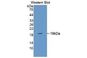 Detection of Recombinant MARCO, Rat using Polyclonal Antibody to Macrophage Receptor With Collagenous Structure (MARCO) (MARCO anticorps  (AA 367-519))