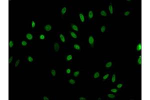 Immunofluorescent analysis of Hela cells (sodium butyrate, 30 mM, 4h) using ABIN7139191 at dilution of 1:100 and Alexa Fluor 488-congugated AffiniPure Goat Anti-Rabbit IgG(H+L)