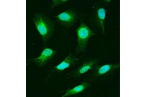 IF analysis of USP25 using anti-USP25 antibody (ABIN7598940). (USP25 anticorps  (AA 1-1053))