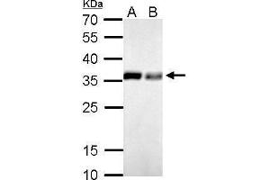 WB Image PPA1 antibody detects PPA1 protein by Western blot analysis. (Pyrophosphatase (Inorganic) 1 (PPA1) anticorps)