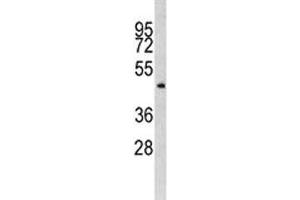 Western blot analysis of ILK antibody and MDA-MB435 lysate.