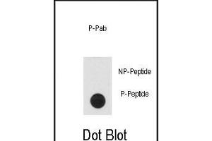 Dot blot analysis of anti-Phospho-CLASP1-p Antibody (ABIN6241038 and ABIN6578931) on nitrocellulose membrane. (CLASP1 anticorps  (pThr656))