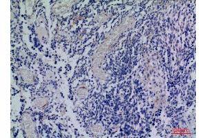 Immunohistochemistry (IHC) analysis of paraffin-embedded Human Brain, antibody was diluted at 1:100.