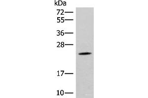 Western blot analysis of Mouse brain tissue lysate using TBPL1 Polyclonal Antibody at dilution of 1:400 (TBPL1 anticorps)