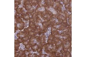 Immunohistochemical staining of human pancreas with RPS19BP1 polyclonal antibody  shows strong cytoplasmic with additional nucleolar positivity in exocrine glandular cells at 1:500-1:1000 dilution. (RPS19BP1 anticorps)