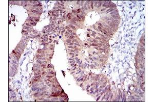 Immunohistochemistry (IHC) image for anti-Cytochrome P450, Family 1, Subfamily A, Polypeptide 1 (CYP1A1) antibody (ABIN1106884)