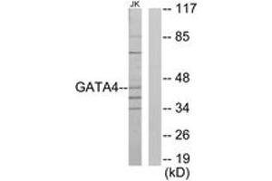 Western blot analysis of extracts from Jurkat cells, using GATA4 Antibody.