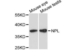 Western blot analysis of extracts of various cell lines, using NPL antibody. (NPL anticorps)