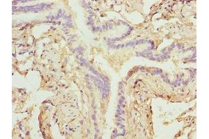 Immunohistochemistry of paraffin-embedded human lung tissue using ABIN7176151 at dilution of 1:100 (ZNF212 anticorps  (AA 1-495))