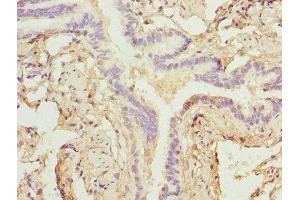 Immunohistochemistry of paraffin-embedded human lung tissue using ABIN7176151 at dilution of 1:100