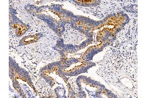 anti-Baculoviral IAP Repeat-Containing 6 (BIRC6) (C-Term) antibody