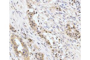 IHC analysis of AKAP 95/AKAP8 using anti-AKAP 95/AKAP8 antibody (ABIN7601553). (AKAP8 anticorps  (AA 380-546))