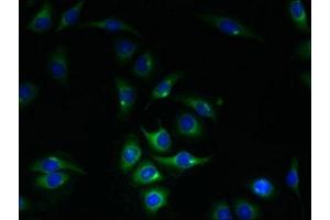 Immunofluorescent analysis of A549 cells using ABIN7150922 at dilution of 1:100 and Alexa Fluor 488-congugated AffiniPure Goat Anti-Rabbit IgG(H+L) (KIAA319L (AA 479-718) anticorps)