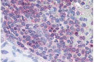 Human Spleen (formalin-fixed, paraffin-embedded) stained with XCR1 antibody ABIN213355 at 2. (XCR1 anticorps  (Extracellular Domain))