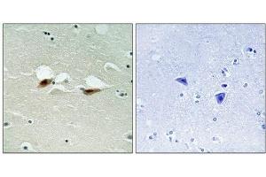 Immunohistochemical analysis of paraffin-embedded human brain tissue using ATF-2 (Phospho-Ser472) antibody (left)or the same antibody preincubated with blocking peptide (right). (ATF2 anticorps  (pSer472))