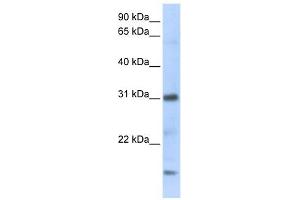 CXCL16 antibody used at 1 ug/ml to detect target protein. (CXCL16 anticorps)