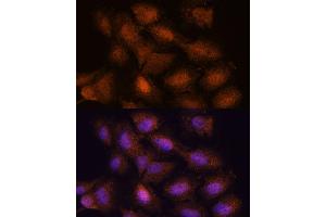 Immunofluorescence analysis of C6 cells using UPF3A antibody (ABIN7271227) at dilution of 1:100. (UPF3A anticorps  (AA 327-476))