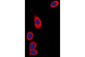 Immunofluorescent analysis of RPS6KC1 staining in Hela cells.